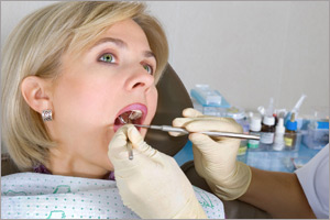 Доступная стоимость удаления зубного камня в «ИНТЕЛмед»