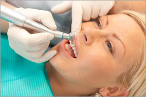 Доступная стоимость удаления зубного камня в «ИНТЕЛмед»
