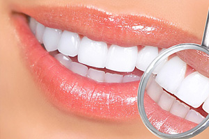 Лечение кариеса шейки зуба