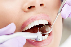Лечение кариеса постоянных зубов