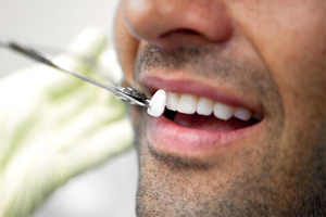 Восстановление отсутствующих зубов