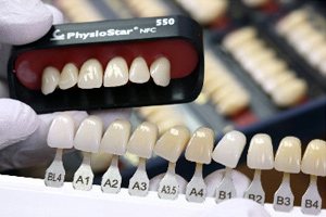 Реставрация зубов композитами