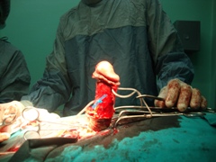 Хирургия в урологии и андрологии